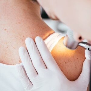 Dokter Kulit Bandung - Photo by Compassion Dermatology